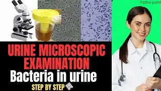 Bacteria in Urine Test | Urine Microscopic Examination |  Full Explanation in Hindi | Urine routine 