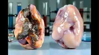 Клетки желудка &rarr; Инопланетный пейзаж: электронный микроскоп раскрывает правду | Секреты желудка