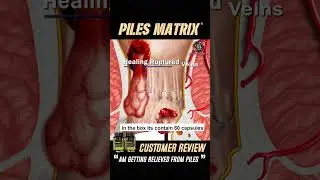 Cure Piles Stage 1 To Stage 4 At Home | Piles Matrix | THE YOGA MAN LAB