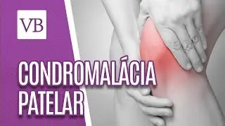 Condromalácia Patelar - Você Bonita (24/07/18)
