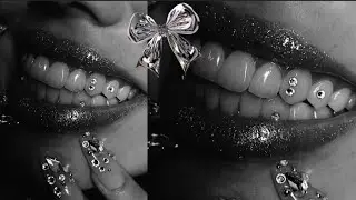 BUNDLE: Pearly white teeth 🤍 prettiest smile 