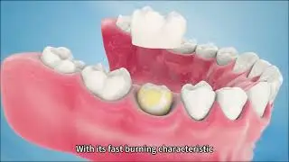Dental Casting Resin