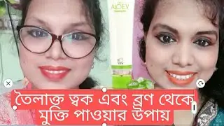 আমি যে প্রডাক্ট ব্যবহার করে ওয়েলি স্কীন এবং ব্রণ থেকে রক্ষা পেয়েছি]] Dxn Aloe-v face gel ]]