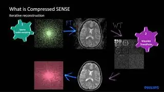 Compressed SENSE webinar by Dr. Jan. W. Casselman