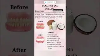 🥥 &ldquo;Start Your Day with This Ancient Secret! Coconut Oil Pulling Benefits You&rsquo;ll Love 💧✨&rdquo;#OilPulling