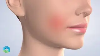 Post-Op: Pain Management | Oral Surgery & Dental Implant Specialists South Carolina