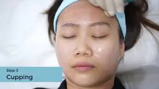 Facial Cupping - Yong Kang TCM Clinic