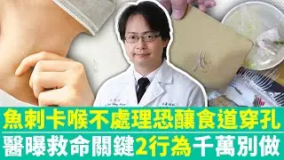 【健康療天室】魚刺卡喉不處理恐釀食道穿孔　醫曝救命關鍵「2行為」千萬別做 @ChinaTimes