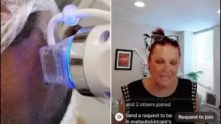 Country Men's Anti-Aging Solution: Carbon YAG Laser