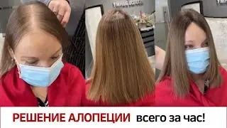 Решение проблемы алопеции с системой волос Hairtalk !