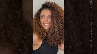 facetas diretas