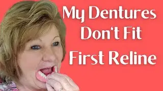 What Is A Soft Reline for Immediate Dentures