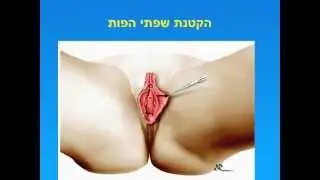 ד