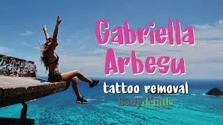 Laser Tattoo Removal Progress | Gabriella Arbesu | Body Details