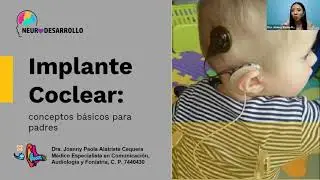 IMPLANTE COCLEAR - 
