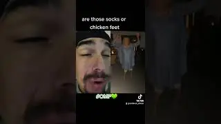 are those socks or chicken feet #omf #funny #dance #chickenfeet #socks #401