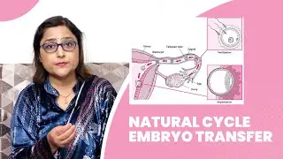 natural cycle embryo transfer in IVF