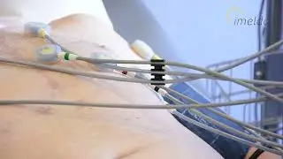 ECG Imeldaziekenhuis