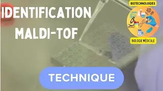 Spectromètre de masse au service de l'identification au laboratoire d'analyses médicale. MALDI-TOF.