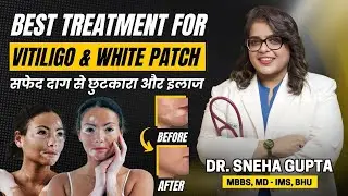 Vitiligo & White Patch Treatment | सफेद दाग से छुटकारा और इलाज | Atomic Clinic | Dr. Sneha Gupta