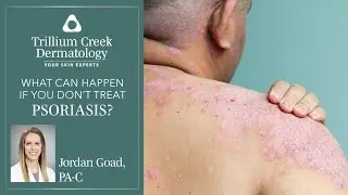 What happens if psoriasis is untreated?
