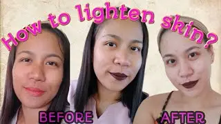 D.I.Y. Skin Bleaching, Safe and Effective| How to whiten skin in 7 days?