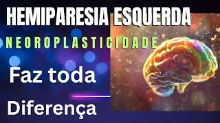 #Hemiparesia Esquerda, #Neuroplasticidade . A evolução com Fisioterapia. 