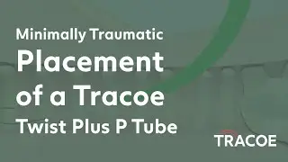 Minimally Traumatic Tube Placement of Tracoe Twist Plus P tube - Percutaneous Dilation Tracheostomy