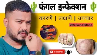 Fungal Infection म्हणजे काय | Symptom,Causes & Treatment | Best Home Remedies #healthtips