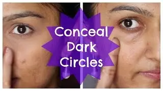 How To Conceal Dark Circles | Indian | Olive | Brown skintone