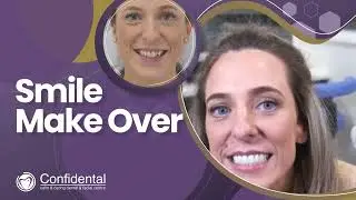 SmileFast Melissa Short YT