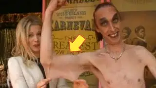 Stretchiest skin in the world - Gary turner - Guinness World Record for stretchiest skin