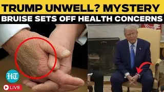 Trump News LIVE | Large Bruise on Trump's Hand Fuels Speculation; White House Says... | Karoline