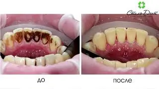 Професииональная чистка AIR FLOW
