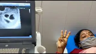 Patient Stories IVF & Infertility Success Stories | #DrPadmajaIVF | IVF Testimonials 2021