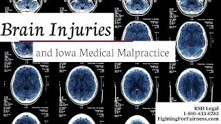 Brain Injuries and Iowa Medical Malpractice