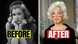 15 Secret Surgeries That Transformed Golden Age Stars Forever. #3 Is SHOCKING