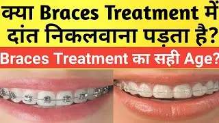 क्या Braces Treatment में दांत निकलवाना पड़ता है? |Braces Treatment करवाने का सही समय |Braces Hindi