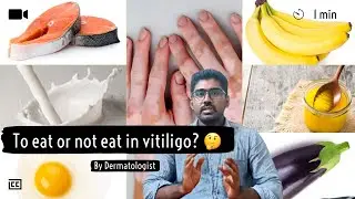1.1️⃣ ошибок, которые вы совершаете, могут привести к этому 🤯 | Еда и витилиго