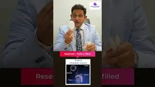 Types of Penile Implants Part2: Inflatable  #andrologist#erectiledysfunction  #urologist