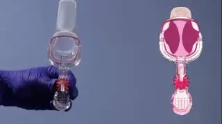 Ultraspec&reg; Sidewall Retractor ► Usage Guideline Video