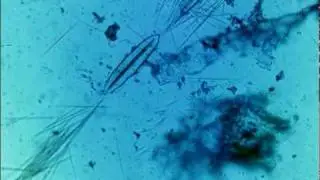 Idioblasts in Action