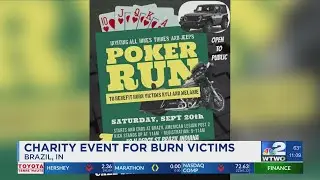Charity event to raise funds for two local burn victims