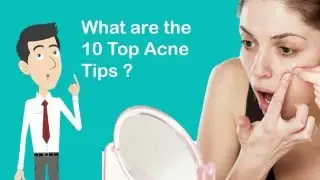 Top 10 Acne Tips