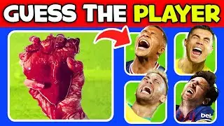 YOU witnessed the WORST INJURIES in Football History!🩸Who Got INJURY?| Football 2025| Ronaldo, Messi