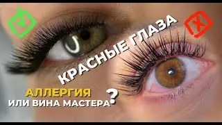 Аллергия на наращивание ресниц:  Выбираем материалы и проверяем реакцию | Наращивание ресниц