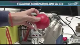 Buonasera Dottore - In esclusiva la mano bionica con il senso del tatto