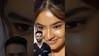 Did Anushka Sen undergo Cat Eye Surgery?