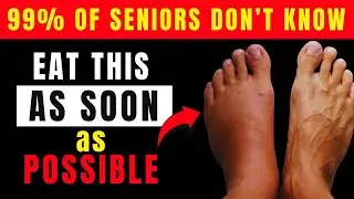 Swollen Legs? Eat These Fruits for Fast Relief and Better Circulation