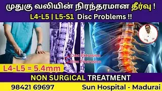 முதுகு வலி + முழங்கால் வலி தீர்வு ! | NON SURGICAL TREATMENT | Sun Hospital Madurai.